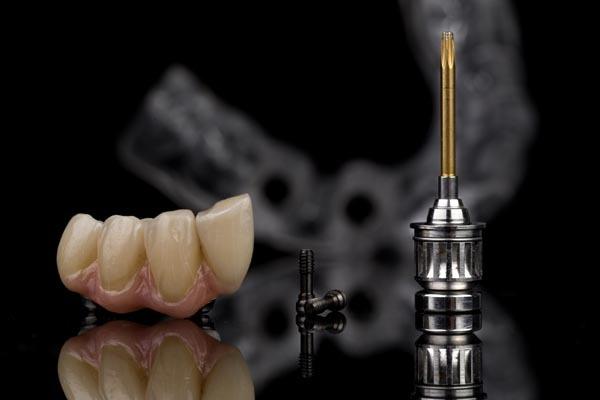 teeth prosthetics