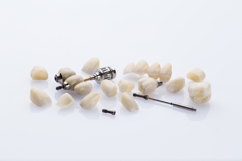 implants