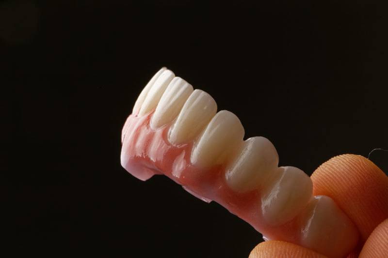 dentures dentures